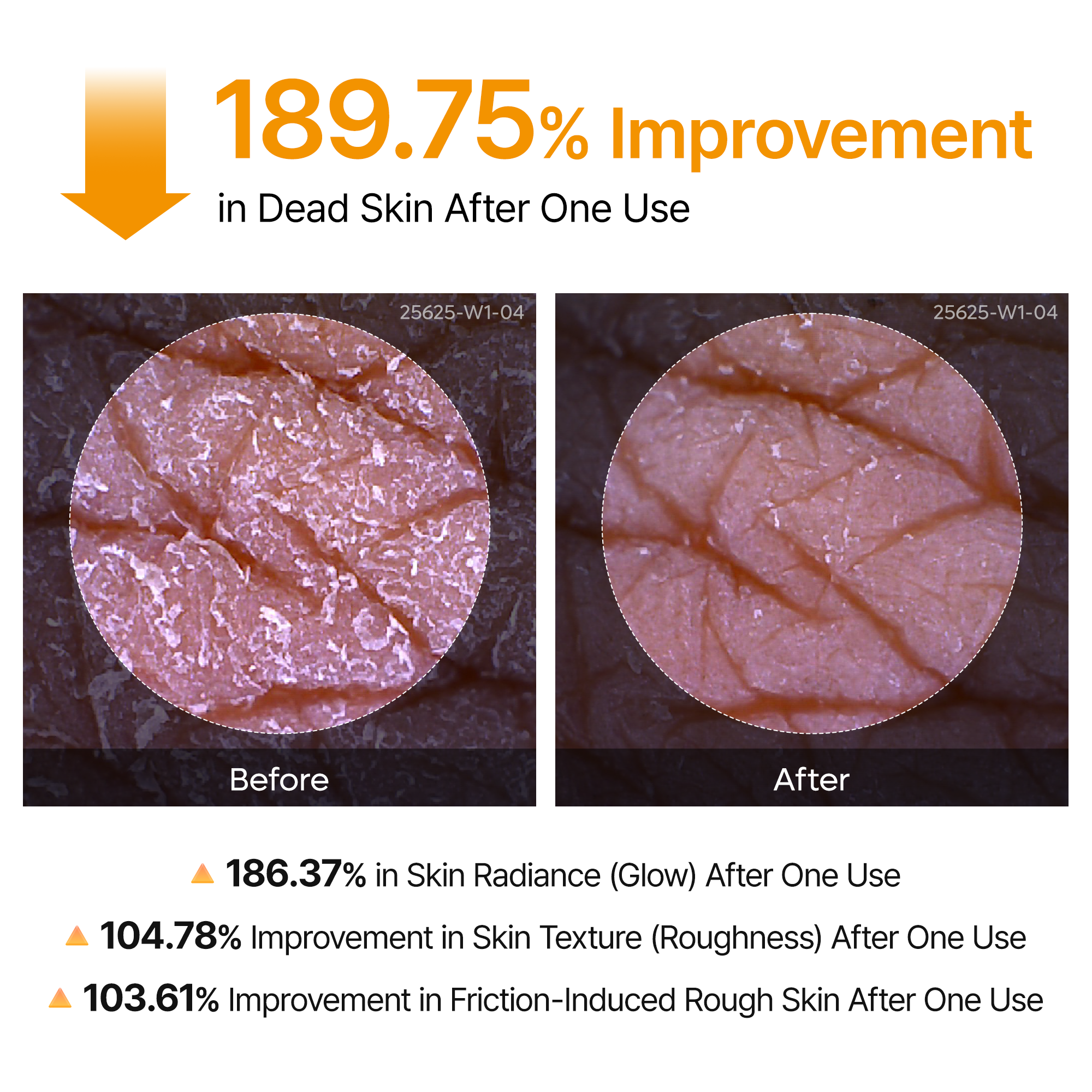 Peel Shot Keratin Care Kojic Acid Turmeric Spray-Shop