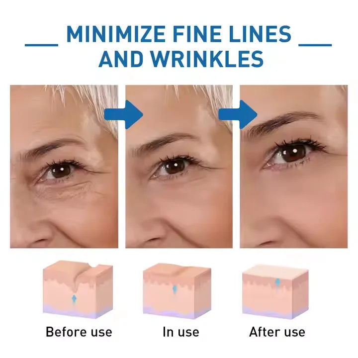 🐝💎 Botox Bee Venom Wrinkle Removal Cream 💎🐝-Shop